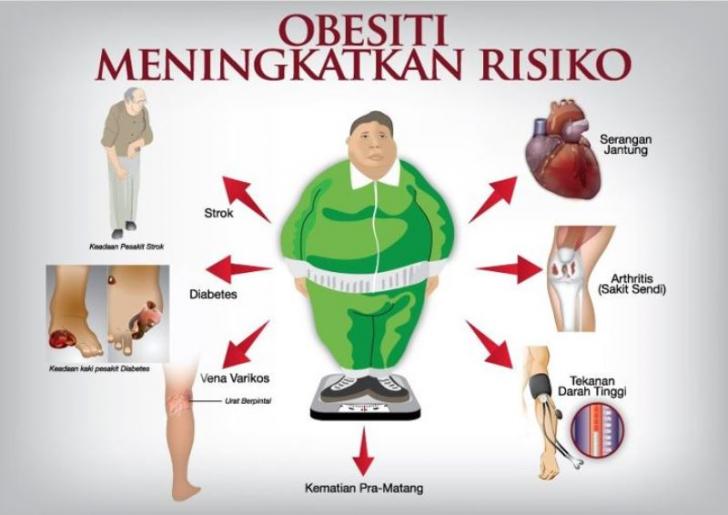 Awas, Obesitas Beresiko Turunkan Kualitas Hidup Anak