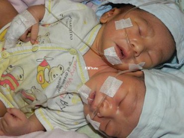 Kapolres Gresik Talangi Biaya Pemakaman Bayi Berkepala Dua