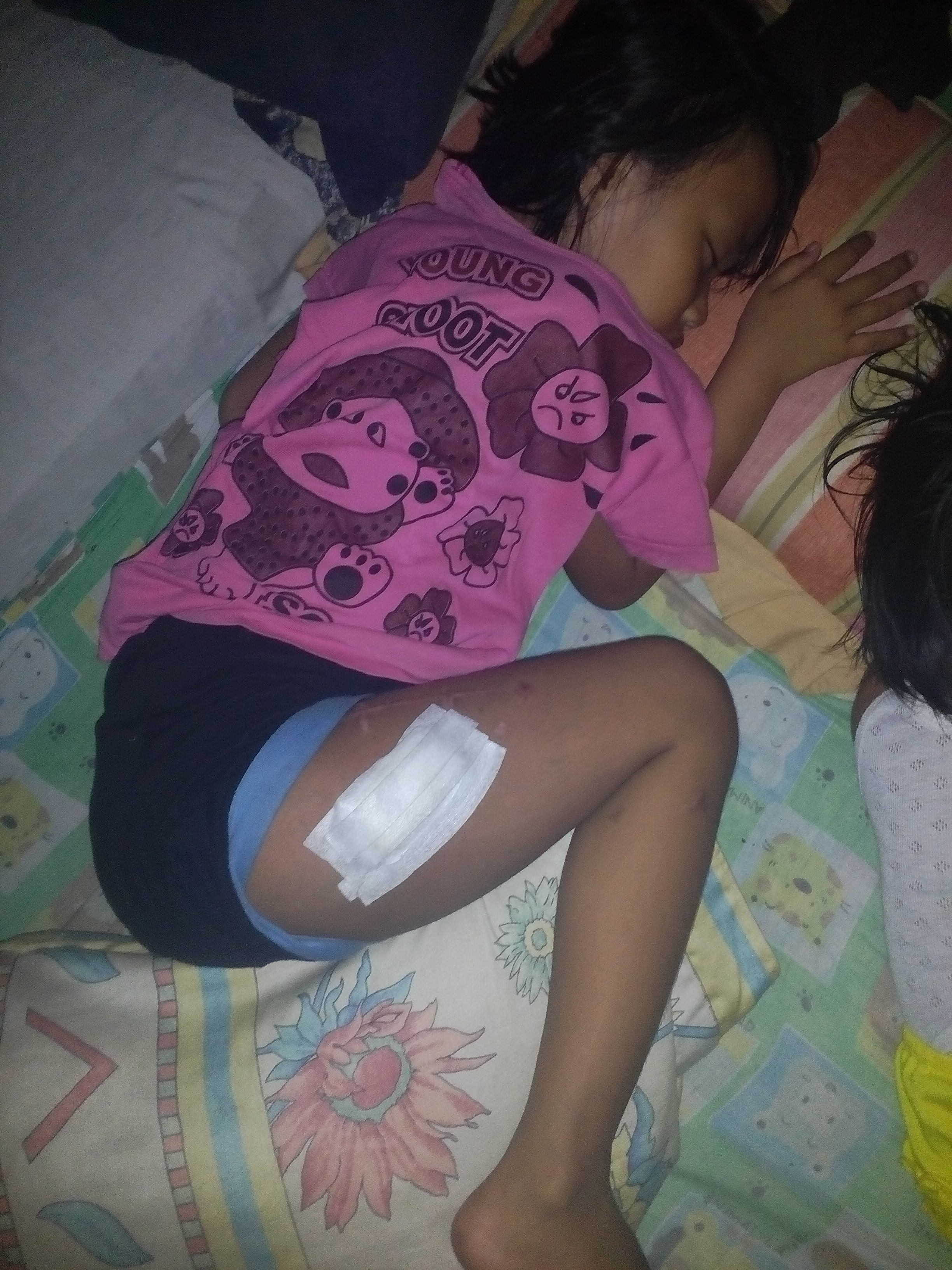 Karena Kondisi Ekonomi, Siswa SD di Inhil Ini Terancam Lumpuh Pasca Ditabrak