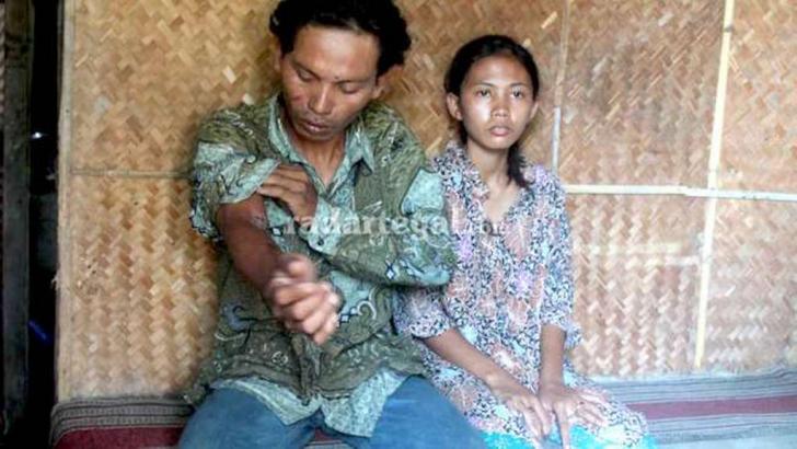 MIRIS! Mantan Polisi Pembantu dan Istrinya Harus Bertahan Hidup dengan Makan Kadal