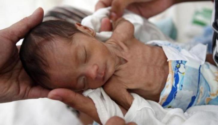 Miris, Saat Indonesia Darurat Gizi, Jumlah Perokok Justru Meningkat Tajam