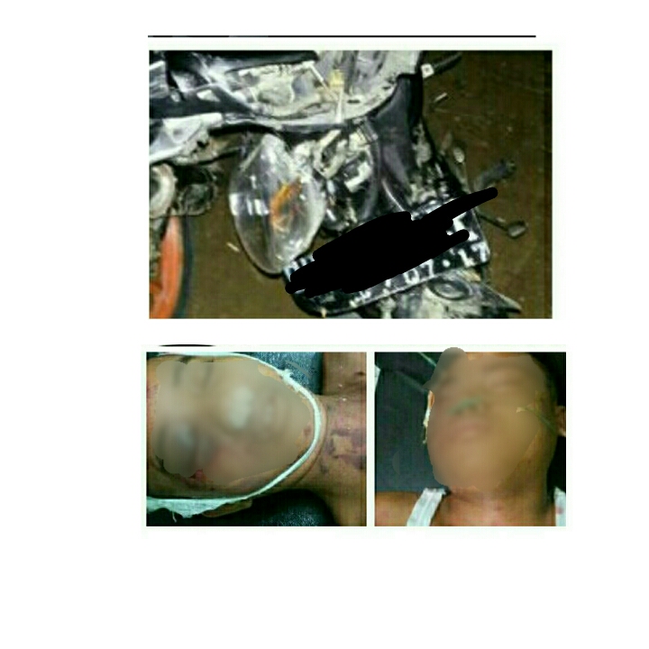 Dua Remaja di Inhil Bertabrakan, 1 Diantaranya Meninggal Dunia