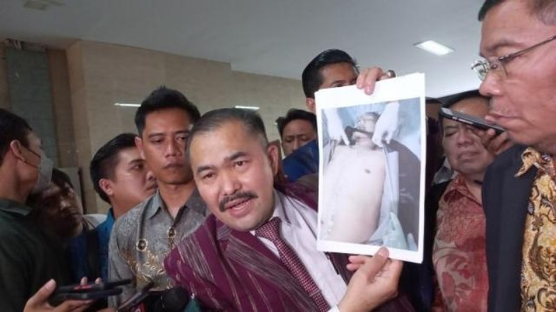 Duh, Diungkap Birgadir J Dibunuh Seorang Psikopat, Menyiksa dengan Keji