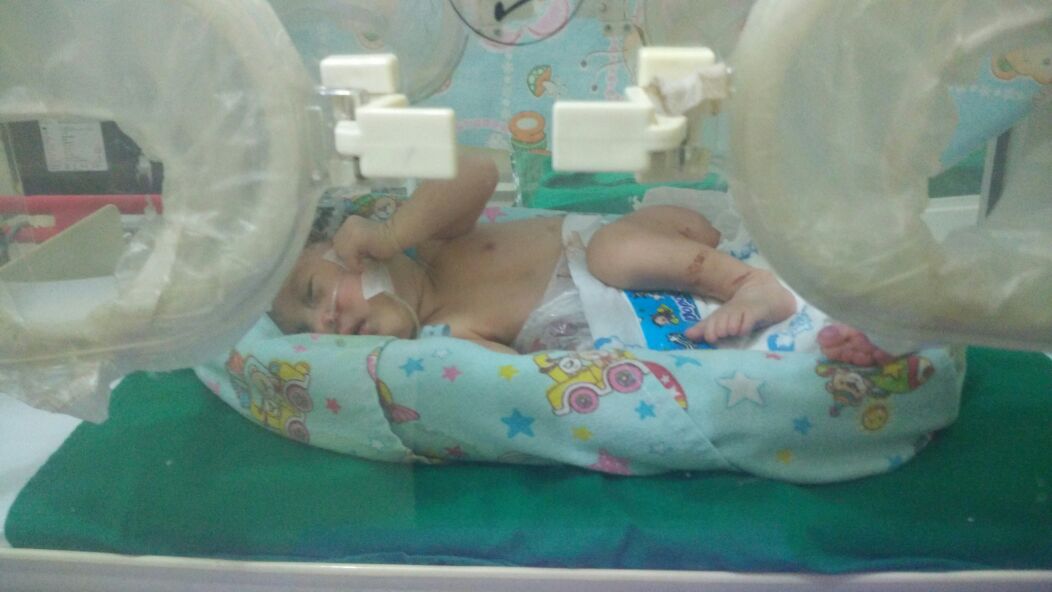 Kembali, di Inhil Ada Bayi Lahir Usus di Luar