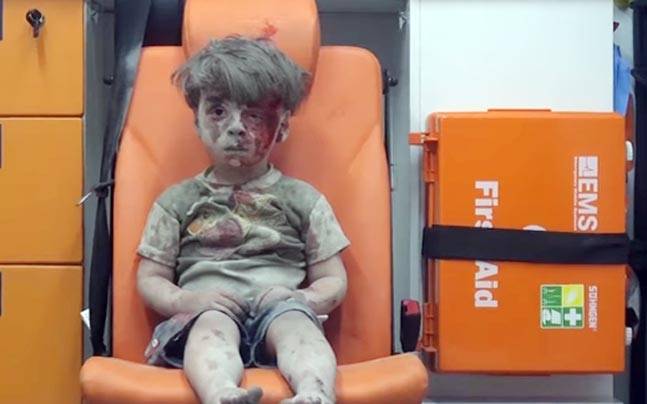 Menyedihkan, Foto Bocah  dalam Ambulans, Potret Kekejaman Perang di Aleppo