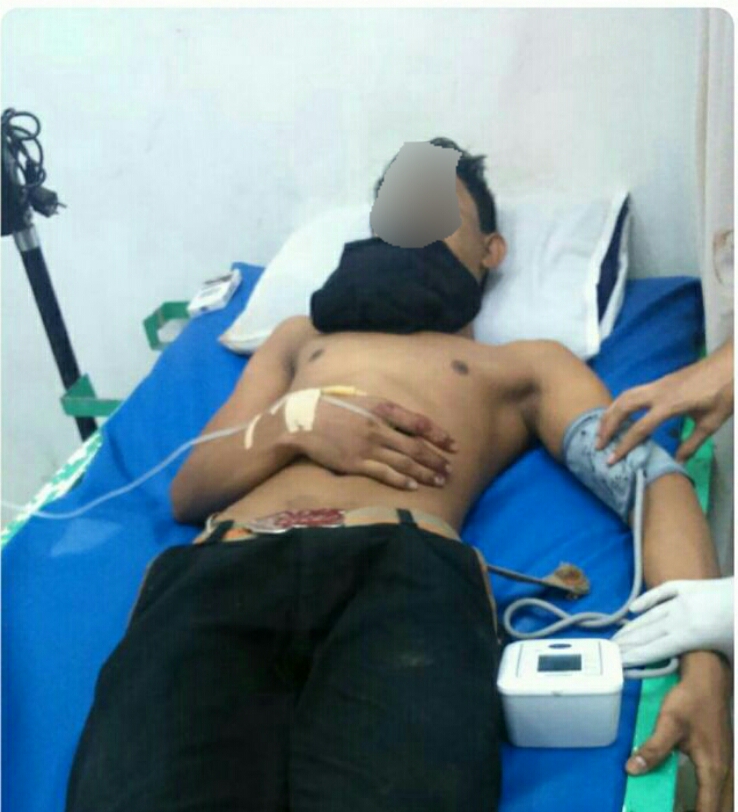 Tanpa Basa-basi, 2 Pemuda di Inhil   Luka-luka Karena Keroyok OTK, Pelaku Masih Buron