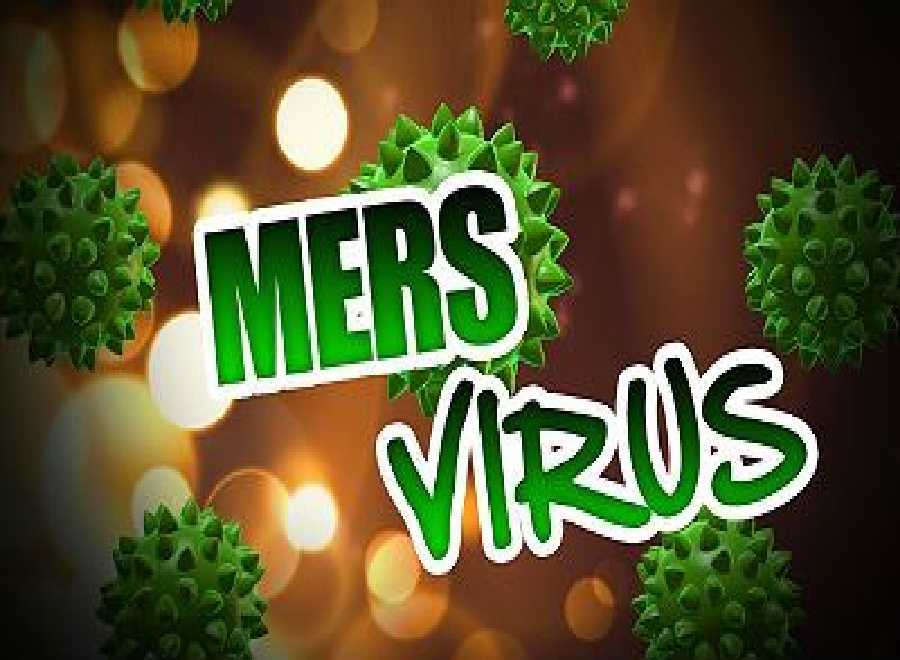 Waduh, Ada Jemaah Haji Riau Minum Kencing Unta, Awas MERS